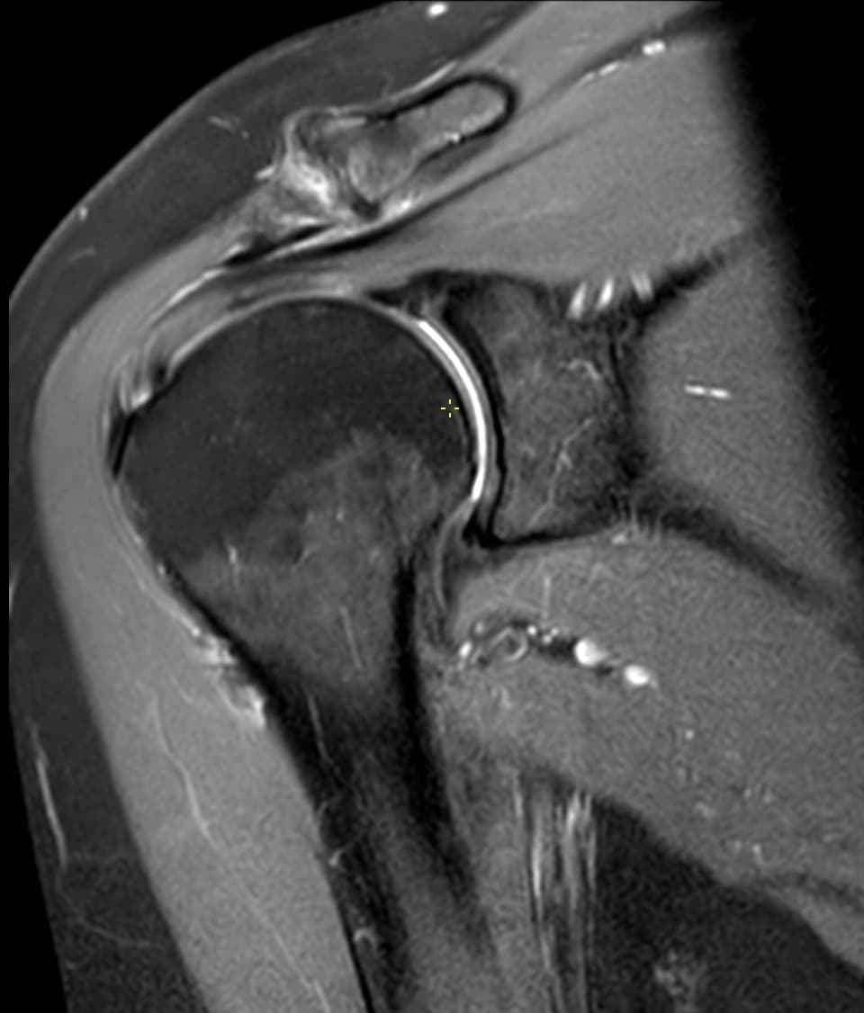 Hvornår giver en muskuloskeletal second opinion mest værdi?