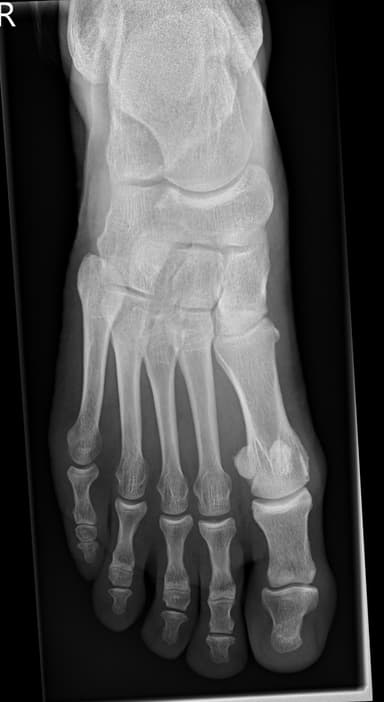 X‑ray second opinion